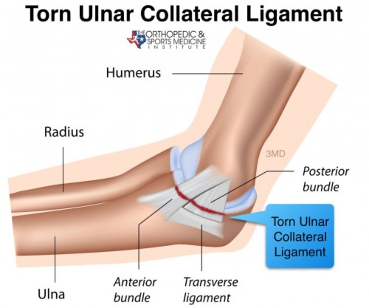 Elbow surgery may be common now, but there was nothing humerus about it in 1974.